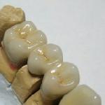 Dental mechanician's homepage