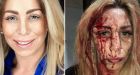 Actress Jennifer Agostini, friends attacked leaving bar