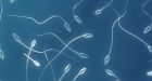 Opinion | What Are Sperm Telling Us'