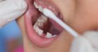 Federal dental benefit officially becomes law