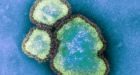 Hamilton child under 5 dies of measles: public health agency