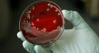 Ottawa targets hospital superbugs
