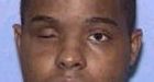 Death row prisoner pulls out eye, eats it