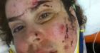 Camrose woman accusing Alberta sheriff of excessive force and sexual assault