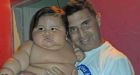 Colombia's fattest baby rescued by charity for life-saving treatment