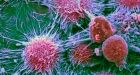 U.S. scientists successfully turn human cancer cells back to normal