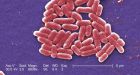 U.S. sees first case of bacteria resistant to all antibiotics
