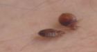 U.S. bedbug wave leads to misuse of pesticides